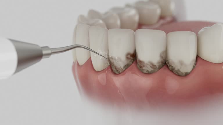 Trusted Root Canal Treatment service in Tatamy, PA - Dentist Open Now